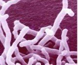 Bifidobacterium Longum