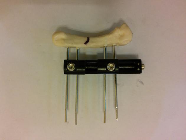 Mini Rail with Scale Orthopedic External Fixator