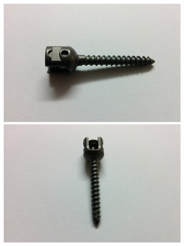 Polyaxil Pedicle Screw Orthopedic Spinal Implant