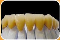 Dental PFM Crown and bridge, Framework and acrylic denture, China dental laboratory
