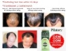 Yuda hair loss treatment--private label&OEM service