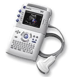 Sonosite Ultrasound180