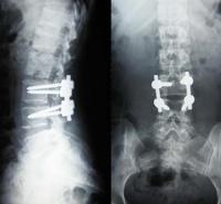 medical dry film