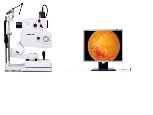 fundus camera