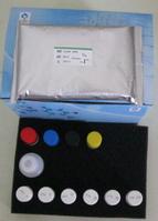 Human Nitric Oxide(NO) ELISA Kit