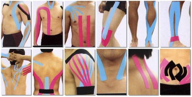 Kinesiology Sports Muscle Tape