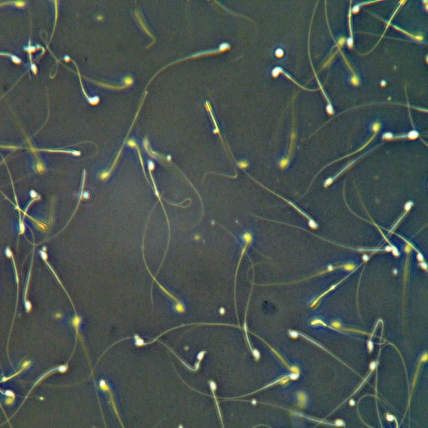 ML CASA10 4 Sperm Counting Chambers