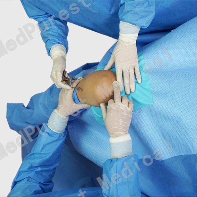 Orthopedic Shoulder Surgical Drapes