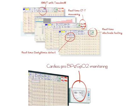 Meditech Cardios PRO Stress ECG Test