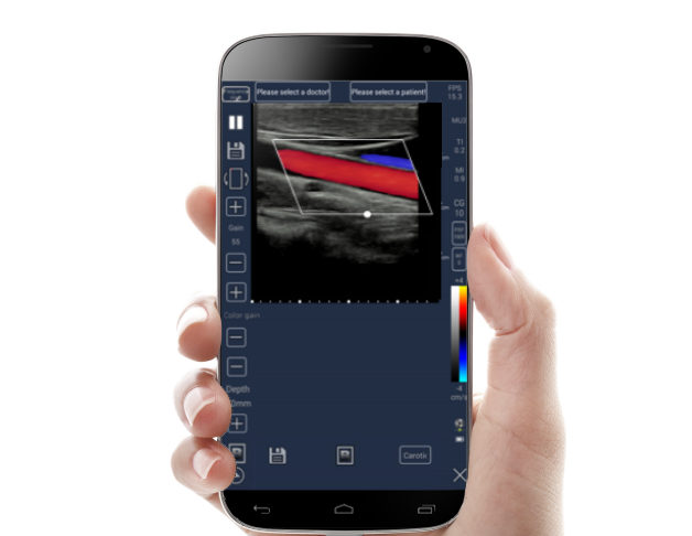 Meditech C-Scan Handheld Touch Screen Color Ultrasound Scanner Medical Supply