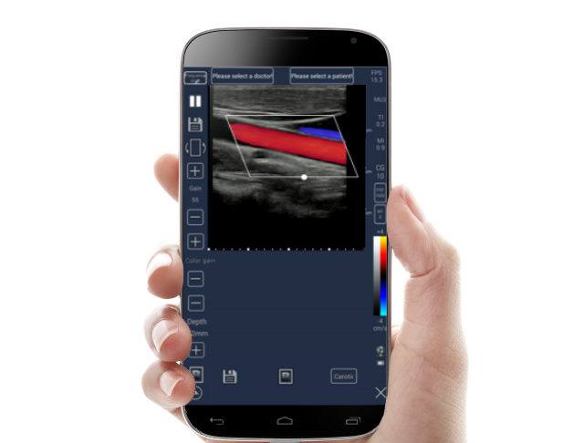 Meditech C Scan Handheld Touch Screen