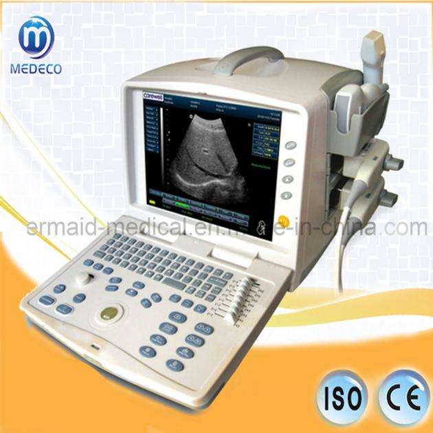 Medical Equipment, Digital Ultrasound Diagnostic Equipment 3300