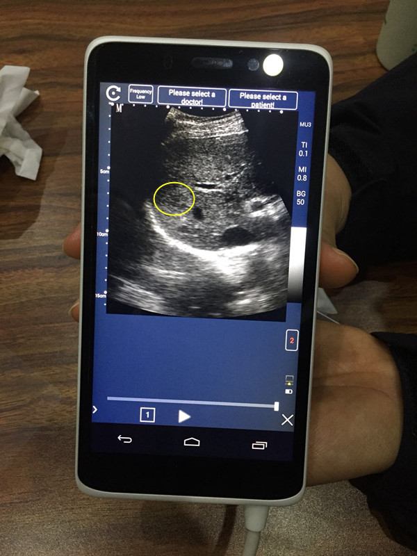 Meditech C Scan Handheld Touch Screen