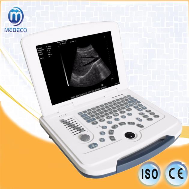 Digital Ultrasound Scanner&#160; Me-580 Portable Ultrasound Diagnostic