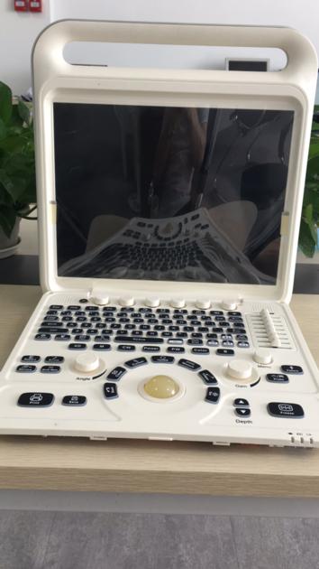 Dolphi C Full Digital Color Doppler