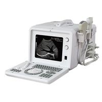 EXRH-300A Portable Ordinary Type Ultrasound Scanner