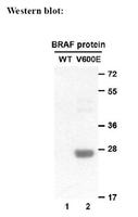 Anti-B-Raf(V600E) Mouse Monoclonal Antibody 