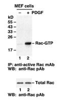 Configuration-specific Monoclonal Antibody Based Rac Activation Assay Kit