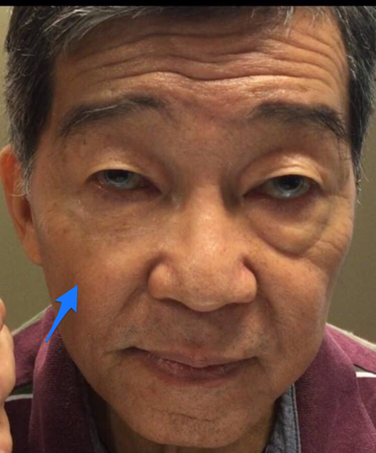 Instant Facelift Serum