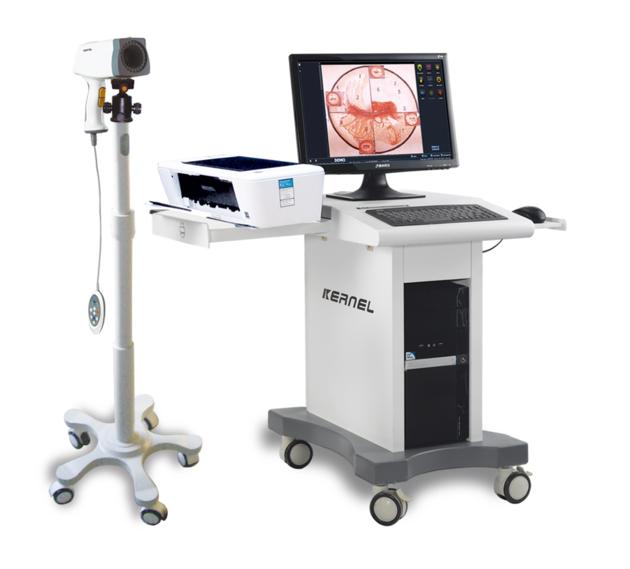 Digital Video Colposcope Amp Image Management