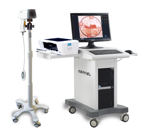 Digital Video Colposcope & Image Management System