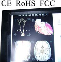 single x-ray film viewer  double x-ray viewer  CE  FCC