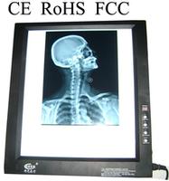 medical LED x-ray viewing box