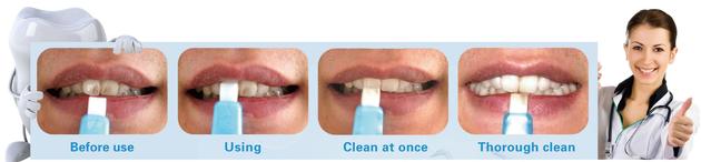 Dental Plaque And Tartar Solution Teeth