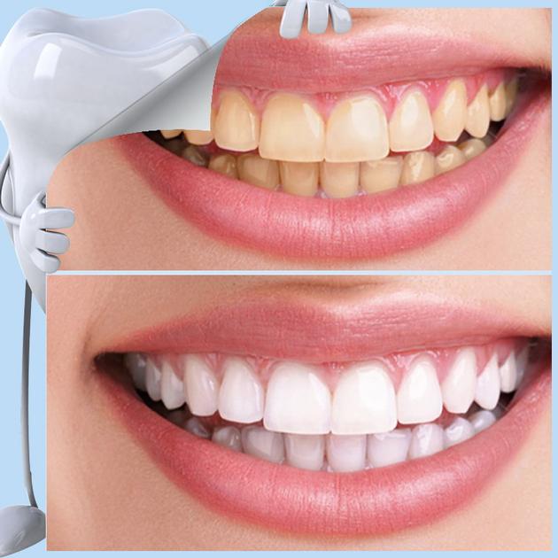 Wholesale Magic Teeth Cleaning Kit Tools