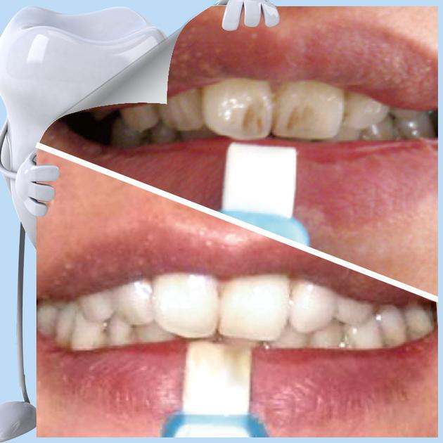 Oral Hygiene Patent Items Nano Technology