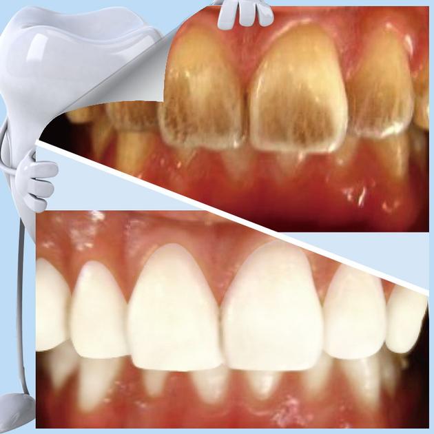 Oral Hygiene Patent Items Nano Technology