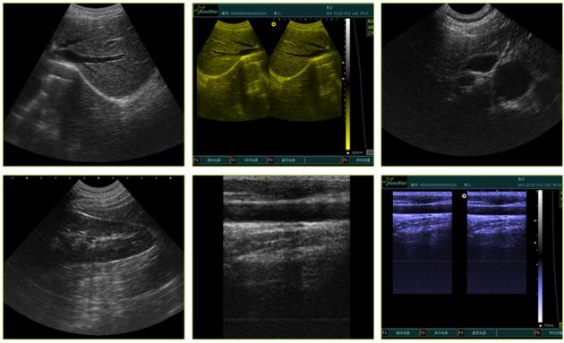 SS 9 PC Based Laptop Ultrasound