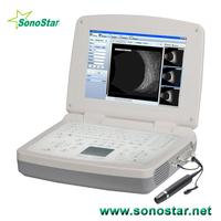 SAB-500 Ophthalmic A/B Scanner