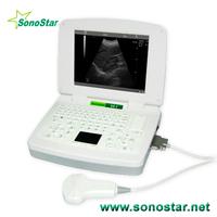 SS-3 Laptop Ultrasound B Scanner(ultrasound,ultrasoni,black white,scanner