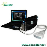UBox-9 Ultrasound B Scanner Box(ultrasound,ultrasoni,black white,scanner)