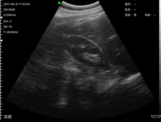 3C Convex Palm B W Ultrasound