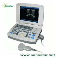 SS-10 Laptop PC Based Ultrasound B Scanner(3D image optional) 