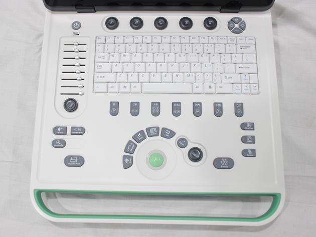 Laptop Color Doppler Ultrasound Machine With