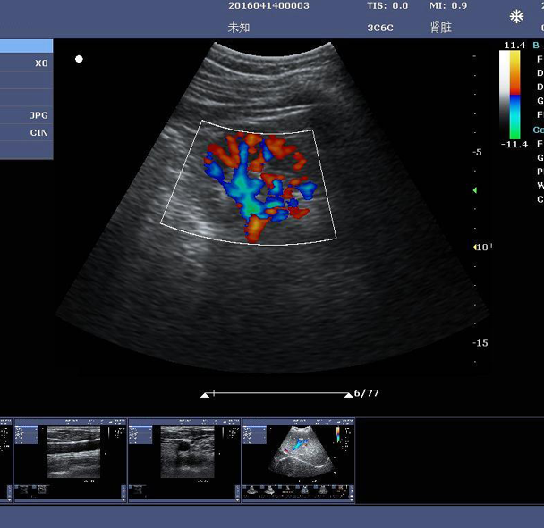 C5Mini Color Doppler Ultrasound System