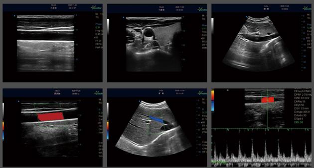 Laptop Color Doppler Ultrasound Machine With