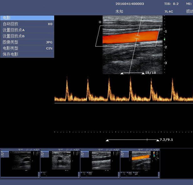 C5Mini Color Doppler Ultrasound System