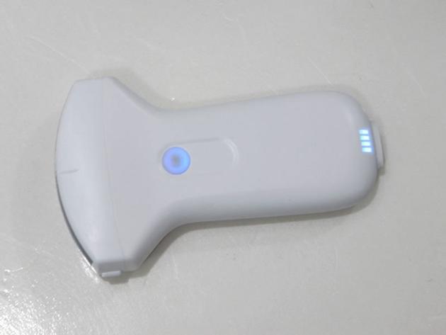 convex palm doppler ultrasound scanner
