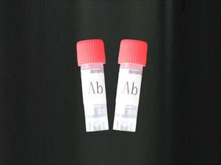 Rabbit anti-rat Hemopexin polyclonal Antibody