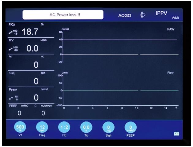 10 4 TFT LCD Screen Anesthesia