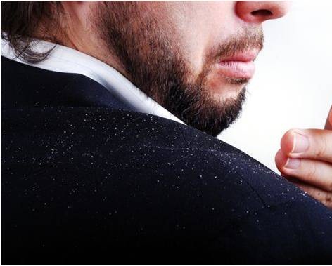 Anti-dandruff agents Piroctone Olamine