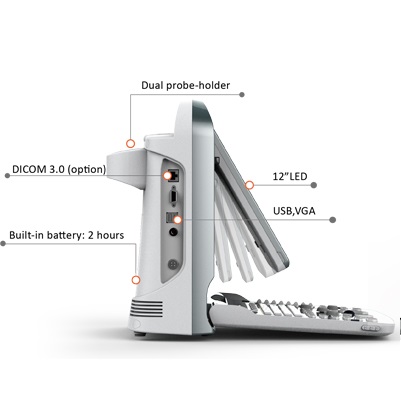 Portable Colour Doppler UltraSound