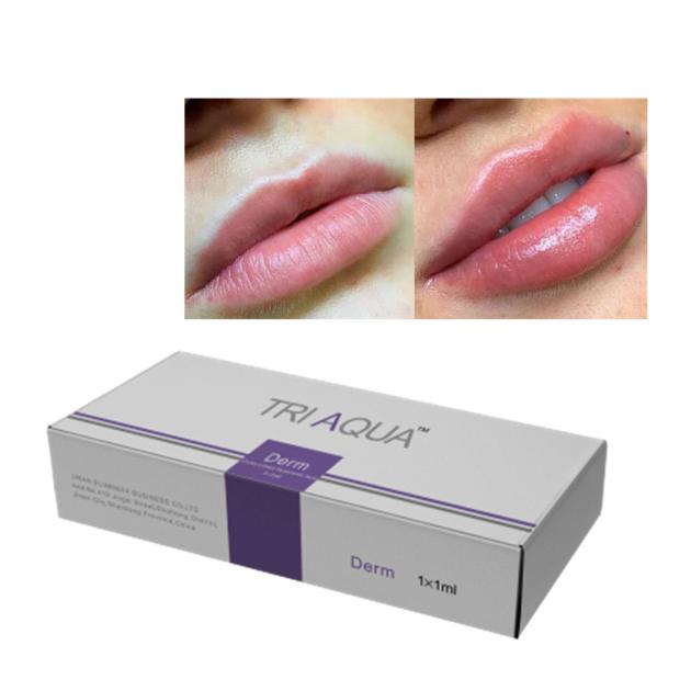 Dermal Filler Hyaluronic Acid