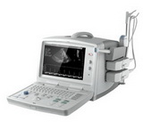 Digital Ultrasound Diagnostic System Product Type: