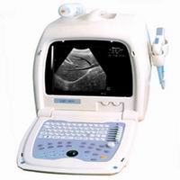 OSEN800 Portable Ultrasound Scanner