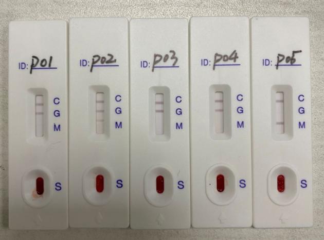 COVID 19 IgG IgM Test Kit